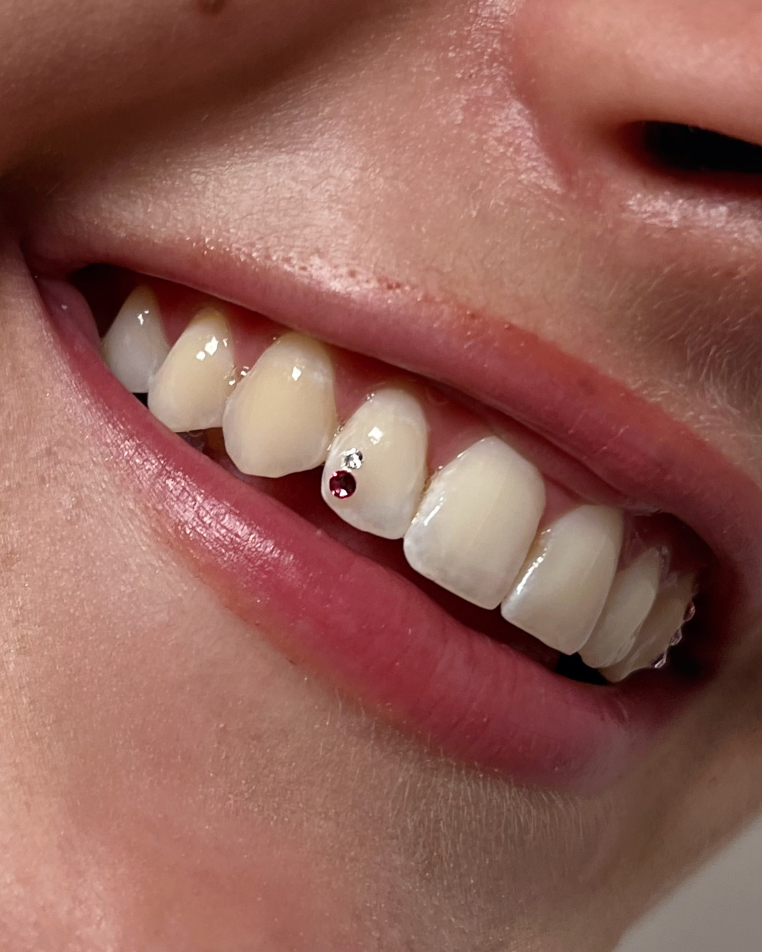 Red and clear round tooth gems on one tooth