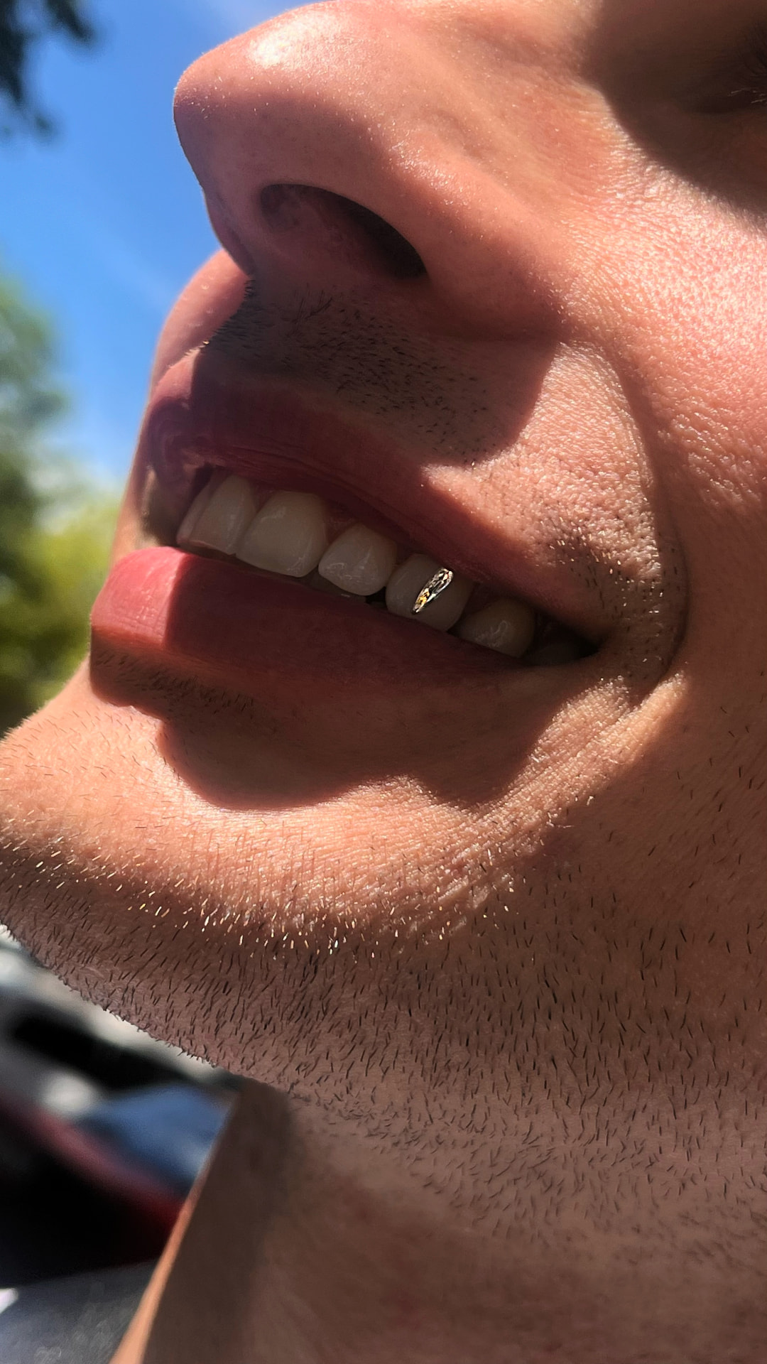 Small gold tooth charm on a canine