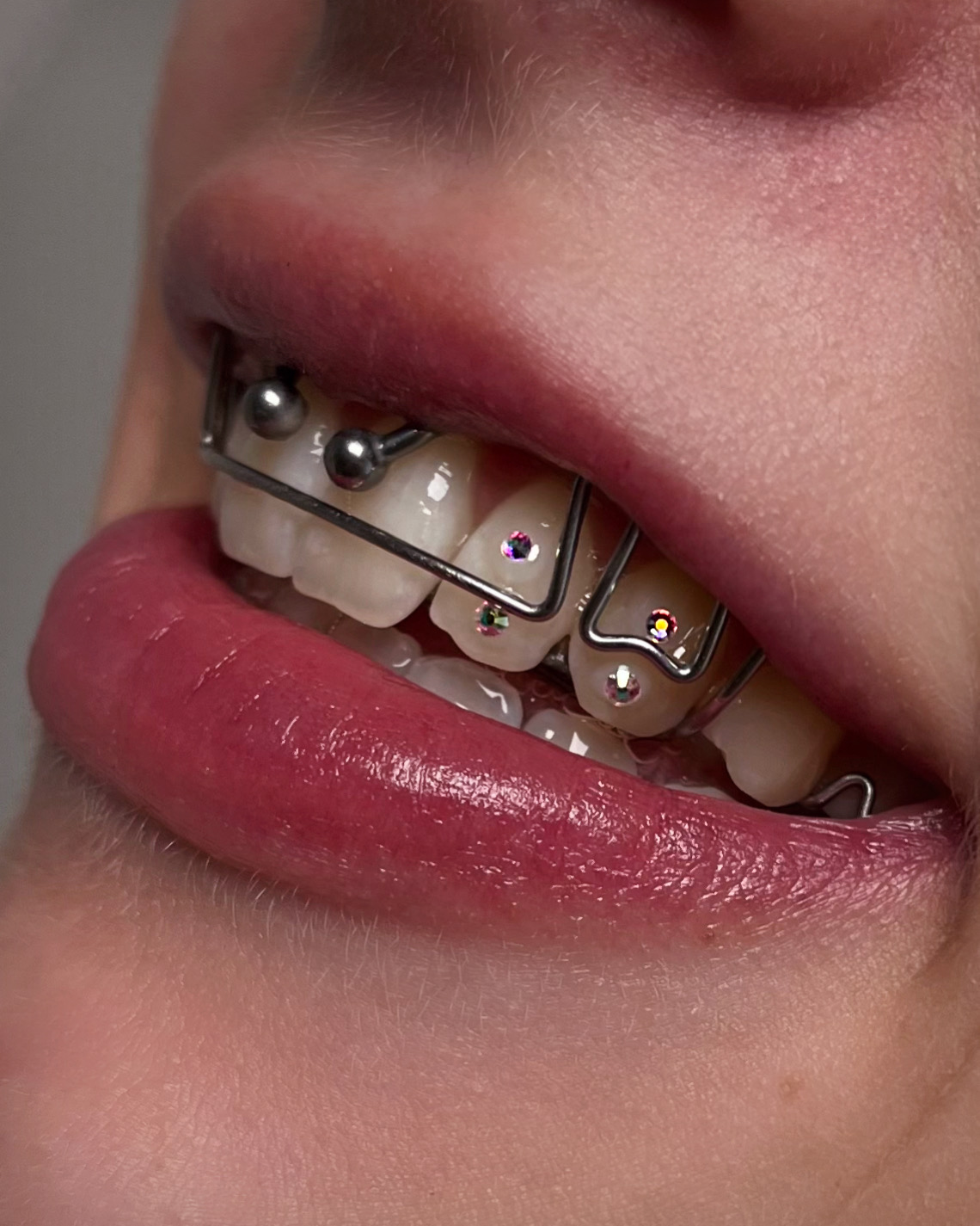 Gold and crystal mix tooth gem set