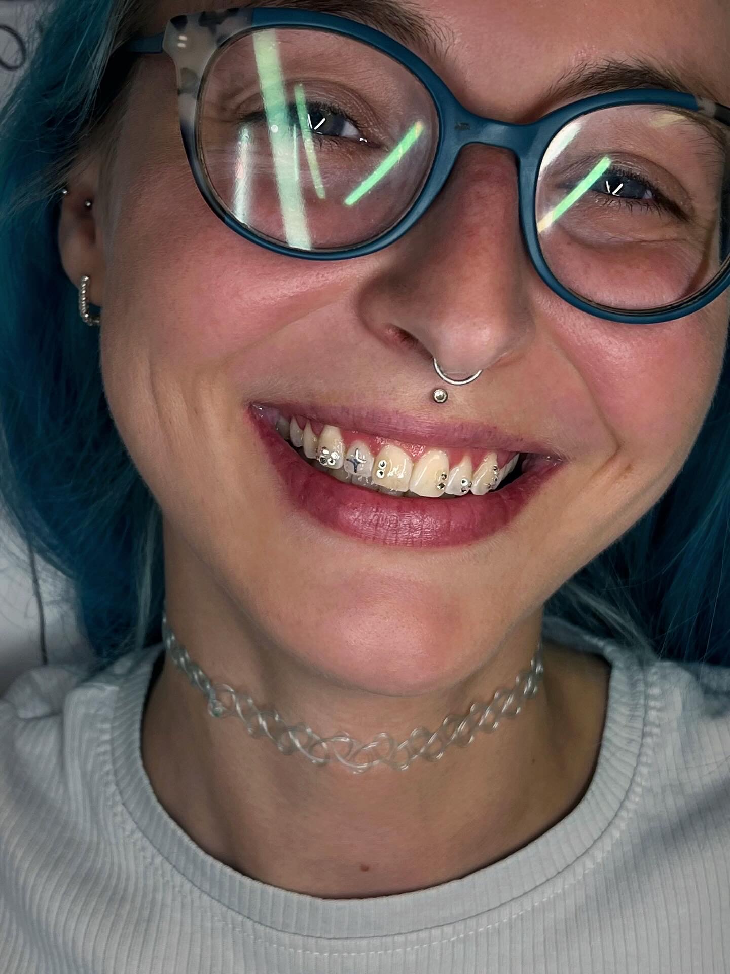 Crystals and charms placed alongside braces